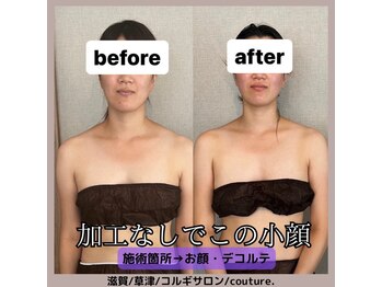 クチュール(couture.)/お顔・デコルテ施術