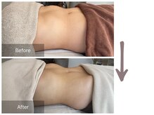 痩せにくくなる下っ腹も骨盤矯正と腸もみでへこむ　脚も軽く！