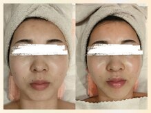 ソウナ(SONA)/ハリ・ツヤUP☆ララピール