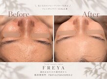 フレイヤ 門前仲町店(FREYA)
