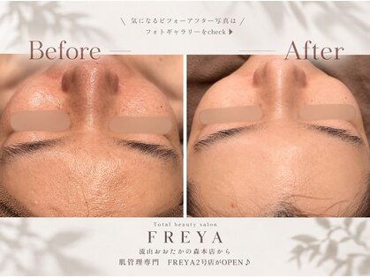 フレイヤ 門前仲町店(FREYA)の写真