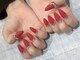 エムズスタイル ネイルバー(M's Style NAIL BAR)の写真/【技術力に自信☆指先美人に♪】当店ダントツ人気！初回オフ無料◎≪ミディアムスカルプ付け放題≫