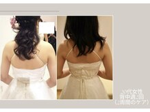 ビューティーサロン アール(R)/痩身マシーン二の腕