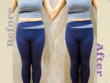 リズボディ(RizBody)/【Before After】施術1回目