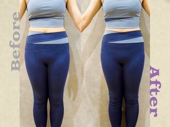 リズボディ(RizBody)/【Before After】施術1回目