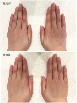 ネイルラボ レモンツリー(Nail Lab LEMON TREE)/施術例ご紹介