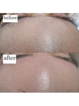 ホワイトラボ 名古屋栄(White labo)/艶肌フェイスワックス