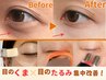 目のくま&目のたるみ集中改善コース40分8800→