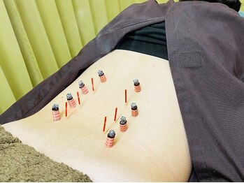 けん鍼きゅう整骨院/鍼灸《腰痛改善》女性限定