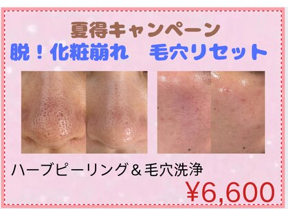ルナ(Luna)の写真