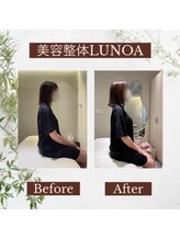 ルノア 梅田院(LUNOA)/圧倒的変化の美容整体[梅田]