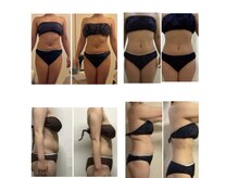 ナースのロミリンパ