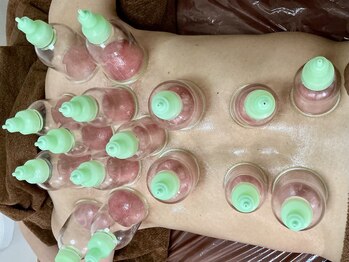 ブルームオーラ 月(BLOOM AURA)/衝撃!ガチガチ疲れに吸い玉