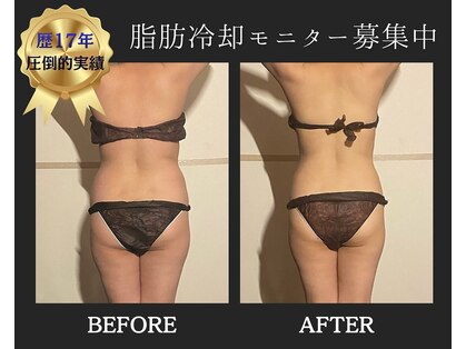 ブルースター(Blue Star)の写真