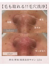 レア(Lea)/詰まりにくい毛穴へ