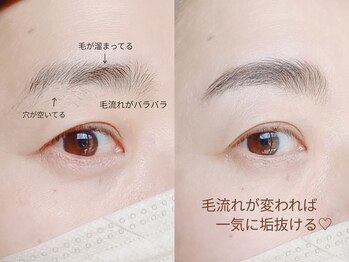 ダンケ(DANKE)/HBLハリウッドブロウリフト