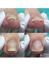 巻き爪補正店 池袋店/巻き爪補正