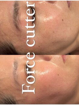 アンバー(amber)/リフトUP・たるみ毛穴改善