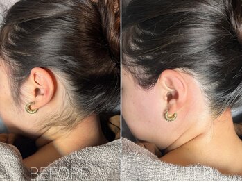 エヴァワックス 大阪 南堀江店(Eva Wax)/脱毛/ブラジリアンワックス