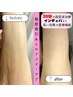 ☆美容施術後の皮膚のひきつれ違和感を超音波機器で改善◎30分3300円
