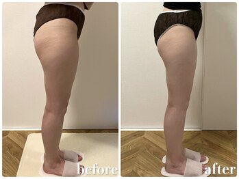 リリィブラン(Lily branc)/【痩身】ヒップ+太もも