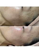 ルーチェエムベルシック(Luce.MBelChic)/エイジングサイン全般に