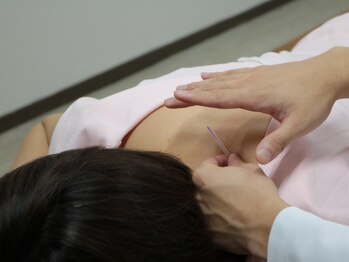 鍼の魔法 恵比寿院の写真/【鍼灸×首肩こり】血流が悪くなり硬直した筋肉に魔法の鍼でアプローチ◎蓄積された痛み・辛さは鍼で解消！