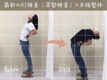 ナオル整体 町田院(NAORU整体)/before/after【6】 町田/整体