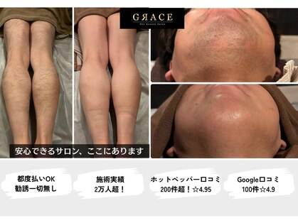 グレイス 天神店(GRACE)の写真