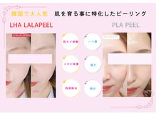 ドルチェナッツ ネオ 府内店(dolce nuts NEO)の雰囲気（ララピール＆プラピール大分で希少新世代LEDヒーライトセット◎）