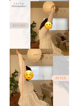 トトノリス(Totonoris)/ビフォーアフター2