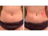 【夏こそ痩せどき】何しても痩せなかった方へ｜リバウンド卒業ダイエット