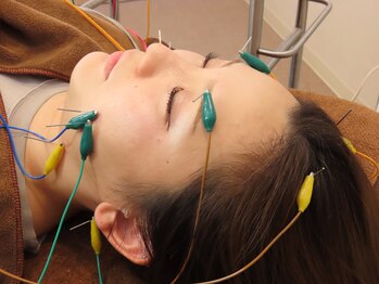 すずらん鍼灸院 整骨院/心地よい刺激の電気を流す美容鍼