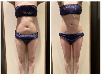 アメジスト/お腹集中セルゼロ