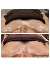 ラナン(ranan)/バストケア