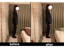 リリス(Lylis)/お客様ビフォー／アフター