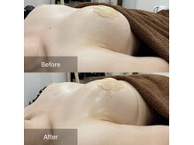 人気No1!!バストアップコース