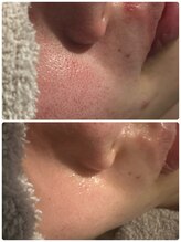 マハロ(mahalo)/クリスタルパック