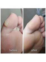 爪切り屋 足楽/