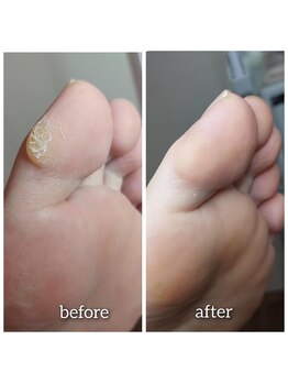 爪切り屋 足楽/