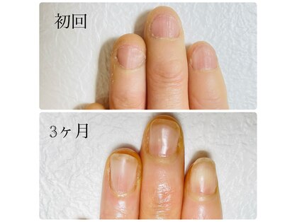グレイス(GRACE)の写真