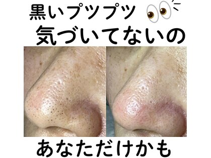 エムアンドエム(M&M)の写真