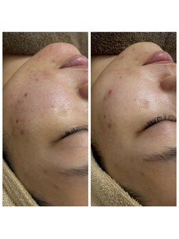 ジャスミン(Jasmine)/