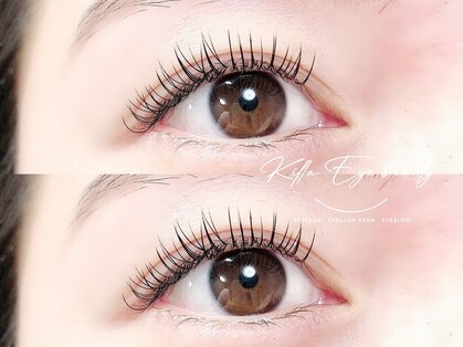 キラアイビューティー 静岡(killa eye beauty)の写真