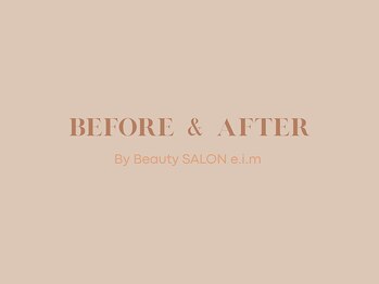 エイム(e.i.m)/BEFORE & AFTER