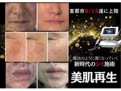 ハナ チュチュ(Hana chuchu)の写真