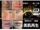 ハナ チュチュ(Hana chuchu)の写真