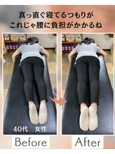 ウェルビーイング整体院 水戸赤塚店(wellbeing整体院)/Before After