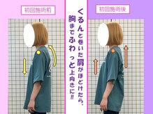八女整体院/猫背/巻き肩改善＋バストアップ