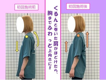 八女整体院/猫背/巻き肩改善+バストアップ